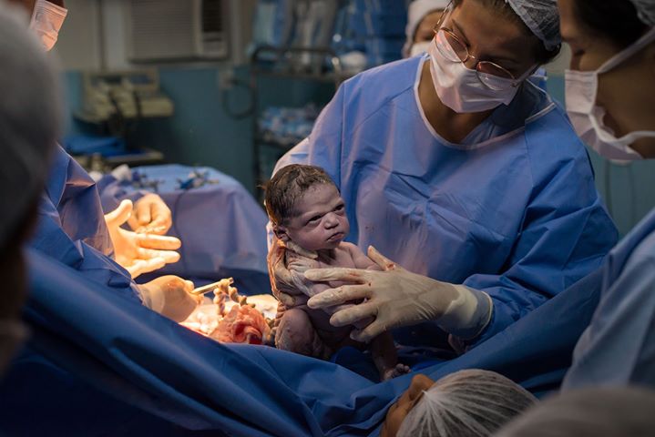 Unimpressed Baby Born In Brazil Is Going Viral